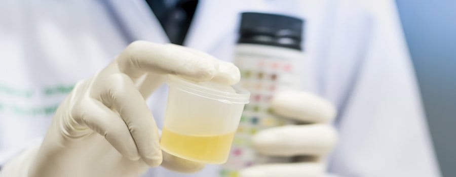 Will additional drug testing become the rule?